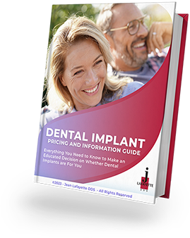 Dental Implant Pricing Guide Book